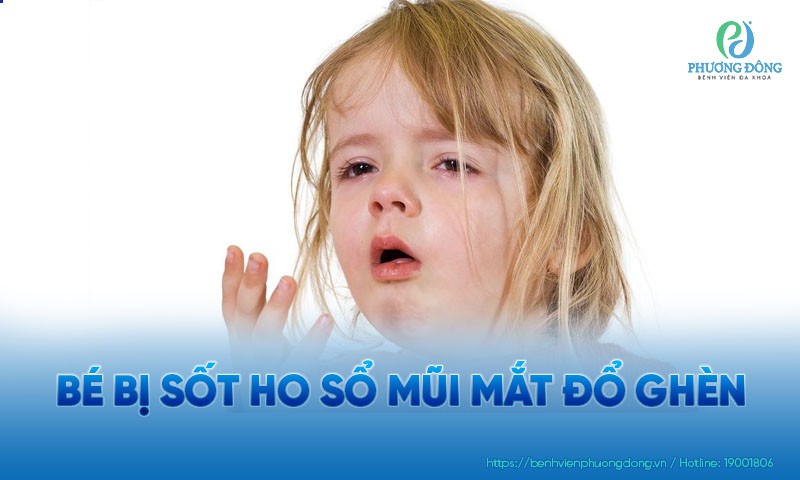 Bé bị sốt ho sổ mũi mắt đổ ghèn do đâu? Hướng khắc phục