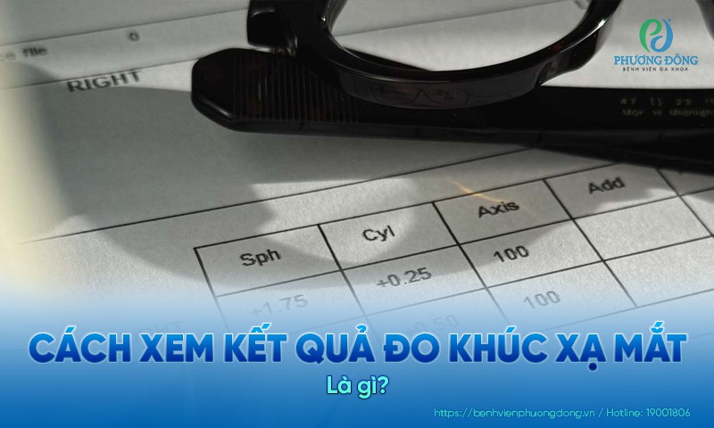Cách xem kết quả đo khúc xạ mắt: Ý nghĩa các chỉ số và ký hiệu