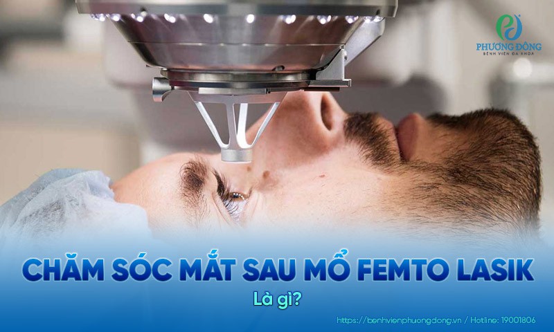 Chăm sóc mắt sau mổ Femto Lasik: Từ chế độ sinh hoạt đến dinh dưỡng