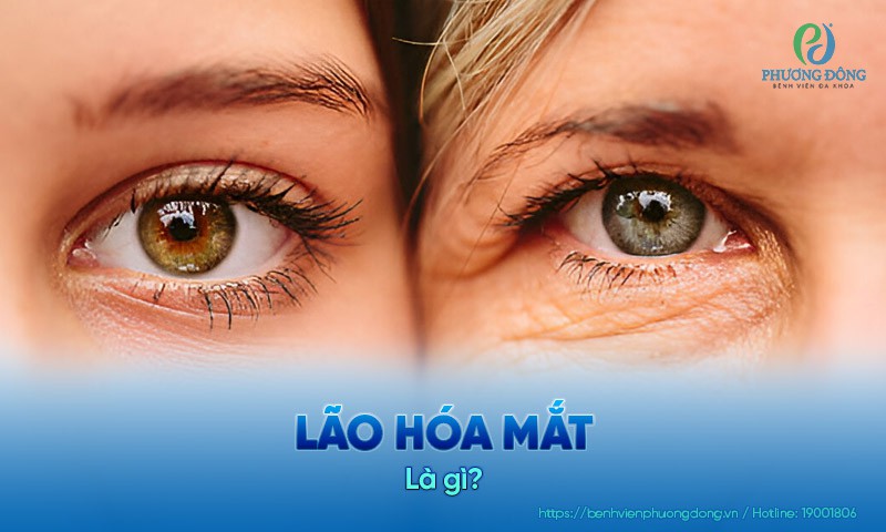 Lão hóa mắt: Triệu chứng, nguyên nhân và cách khắc phục