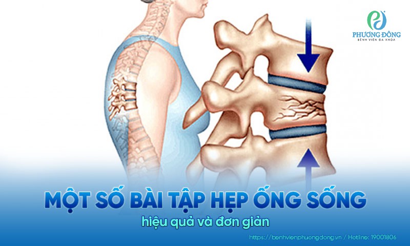 Một số bài tập hẹp ống sống hiệu quả và đơn giản