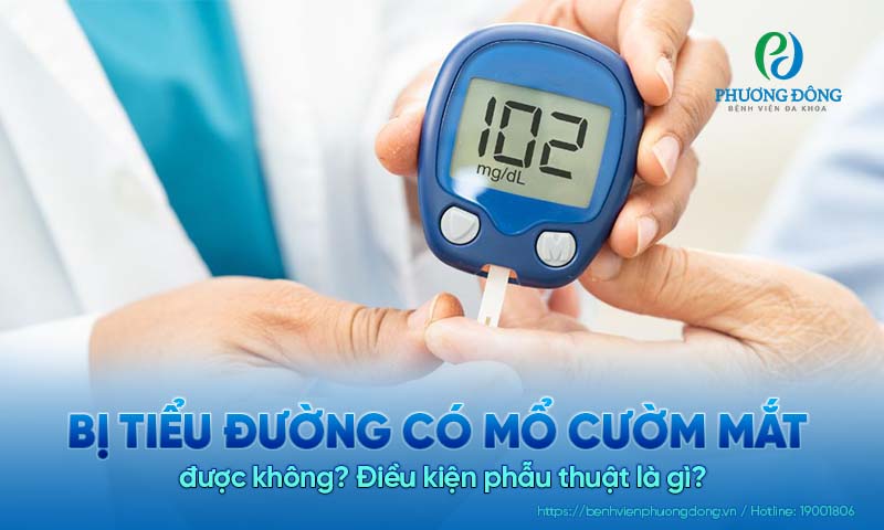 Bị tiểu đường có mổ cườm mắt được không? Điều kiện phẫu thuật là gì?
