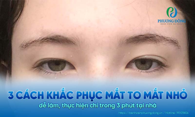  3 Cách khắc phục mắt to mắt nhỏ dễ làm, thực hiện chỉ trong 3 phút tại nhà 