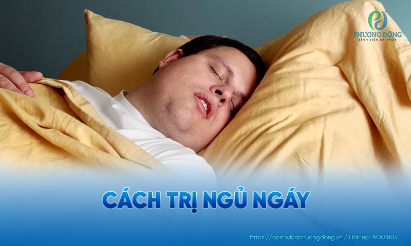 Cách trị ngủ ngáy hiệu quả bằng mẹo và can thiệp chuyên khoa