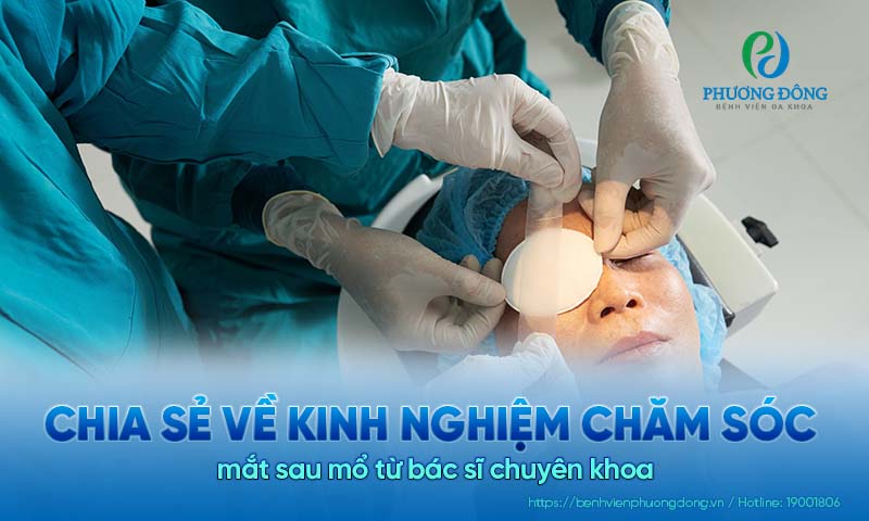 Chia sẻ về kinh nghiệm chăm sóc mắt sau mổ từ bác sĩ chuyên khoa