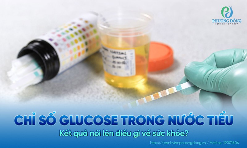 Chỉ số glucose trong nước tiểu: Kết quả nói lên điều gì về sức khỏe?
