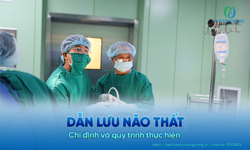 Kỹ thuật dẫn lưu não thất: Chỉ định và quy trình thực hiện 
