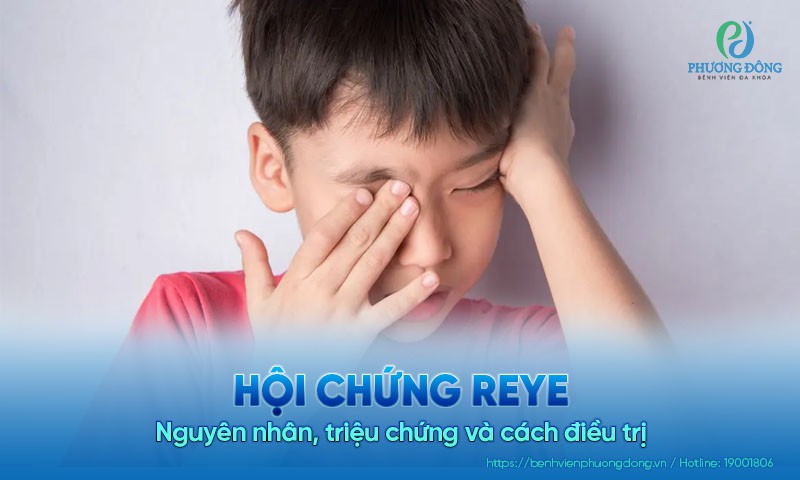 Hội chứng Reye: Nguyên nhân, triệu chứng và cách điều trị