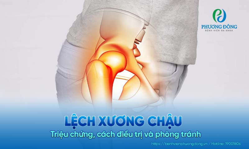Lệch xương chậu: Triệu chứng, cách điều trị và phòng tránh