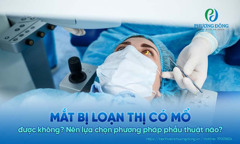 Mắt bị loạn thị có mổ được không? Nên lựa chọn phương pháp phẫu thuật nào?