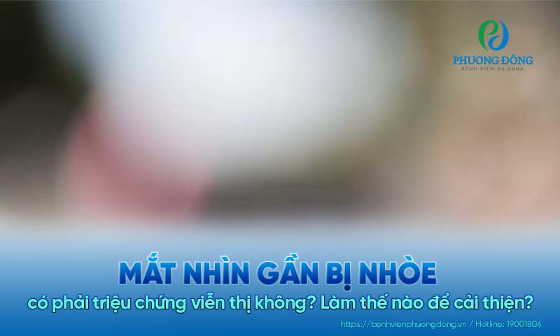 Mắt nhìn gần bị nhòe có phải bị viễn thị không? Làm thế nào để cải thiện?