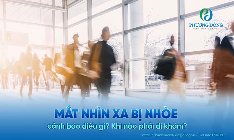 Mắt nhìn xa bị nhòe cảnh báo điều gì? Khi nào phải đi khám? 
