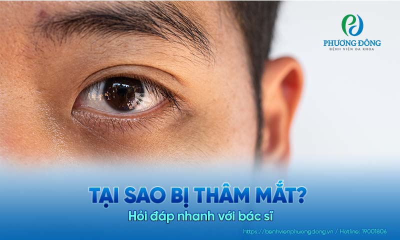 Hỏi đáp nhanh với bác sĩ: Tại sao bị thâm mắt?