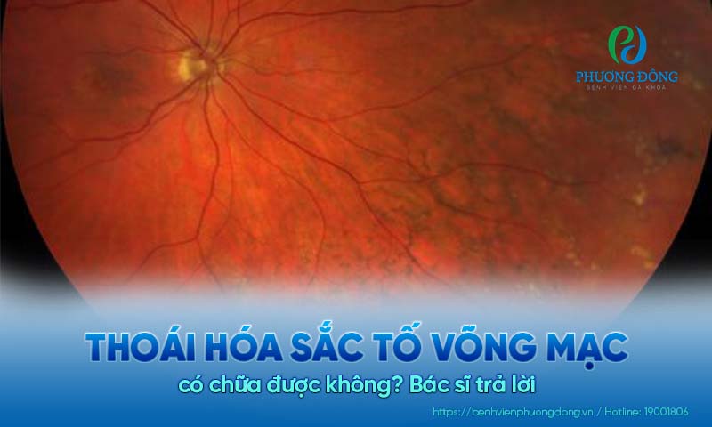 Thoái hóa sắc tố võng mạc có chữa được không? Bác sĩ trả lời 