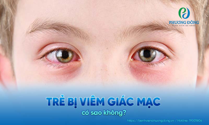 Trẻ bị viêm giác mạc có nguy hiểm không?