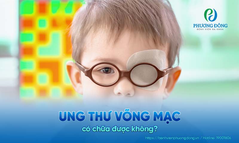 Bệnh nhân hỏi: Bệnh ung thư võng mạc có chữa được không?