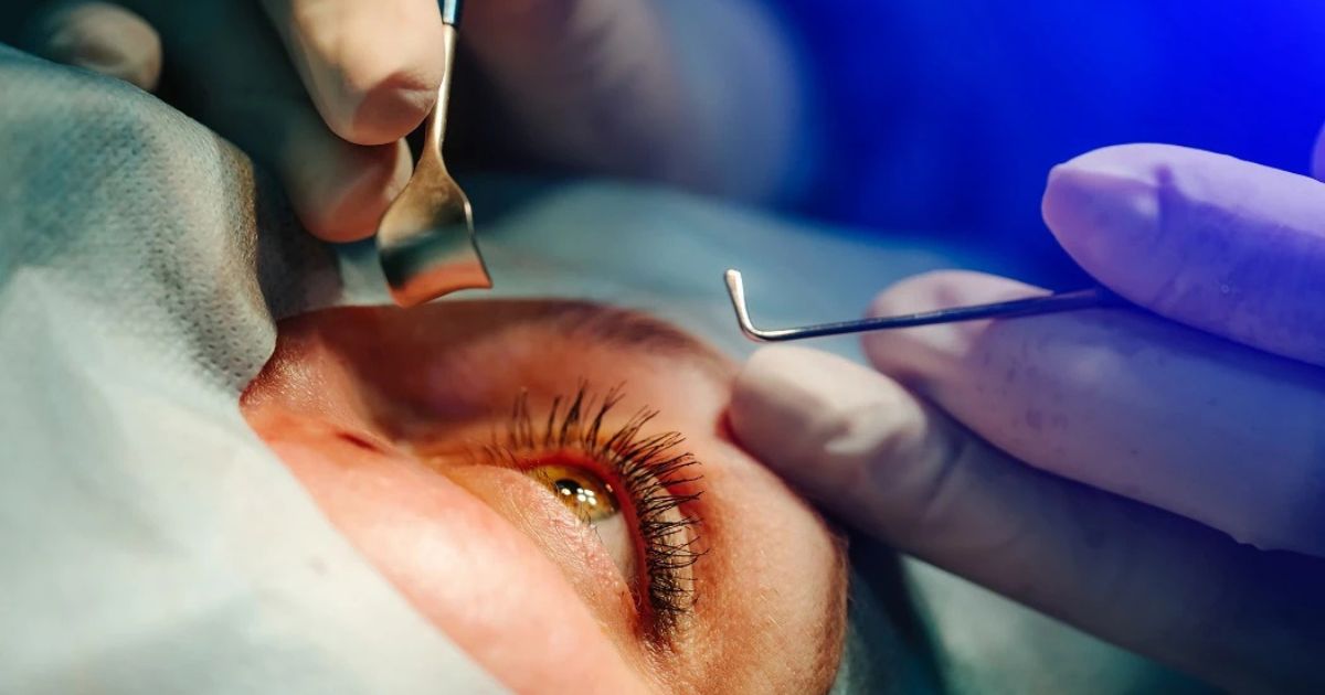 Việc điều trị tập trung vào bảo tồn thị lực tối đa cho người bệnh 