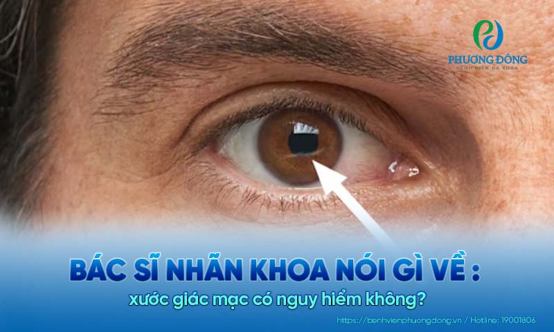 Bác sĩ Nhãn khoa nói gì về: Xước giác mạc có nguy hiểm không? 