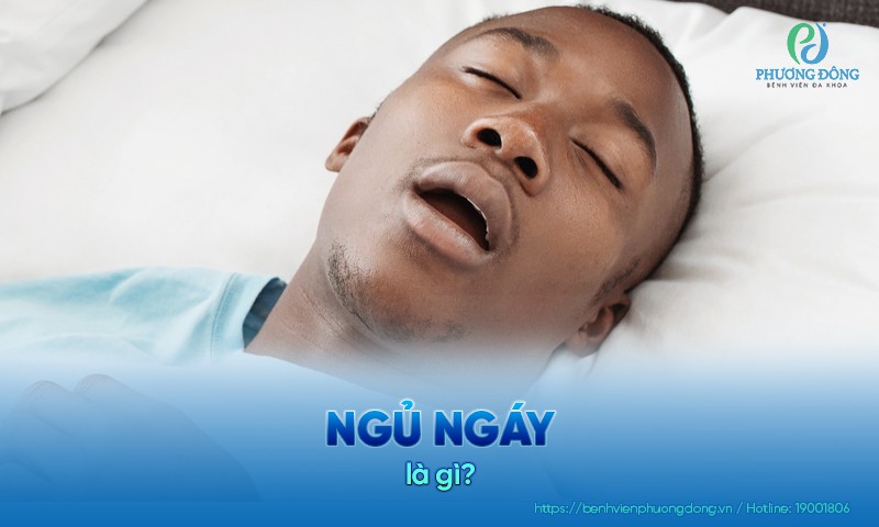 Ngủ ngáy: Nguyên nhân, triệu chứng và phương pháp điều trị
