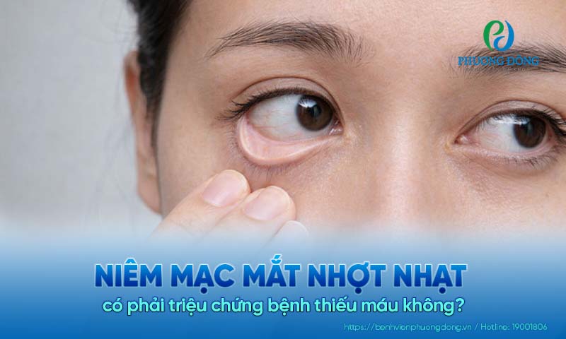 Niêm mạc mắt nhợt nhạt có phải triệu chứng bệnh thiếu máu không?