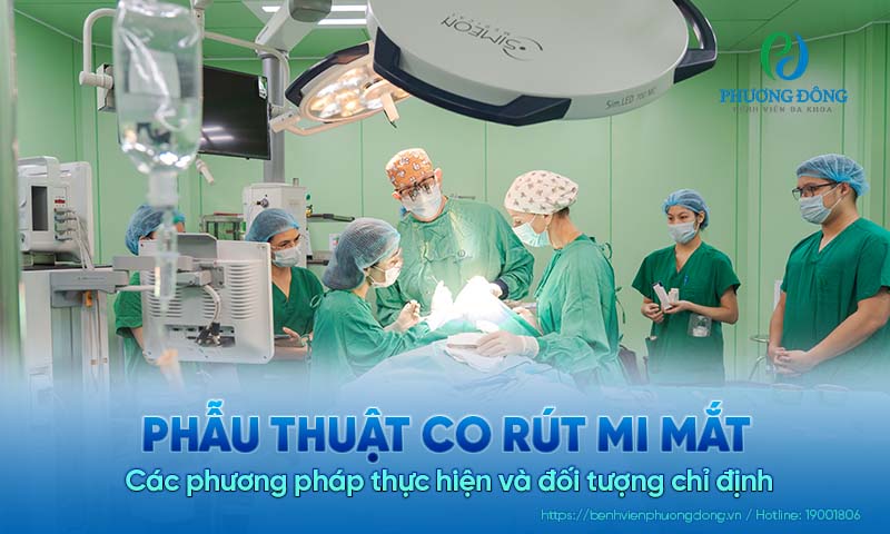Phẫu thuật co rút mi mắt: Các phương pháp thực hiện và đối tượng chỉ định 