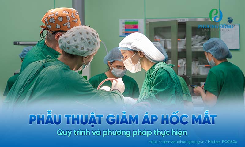 Phẫu thuật giảm áp hốc mắt: Quy trình và phương pháp thực hiện  