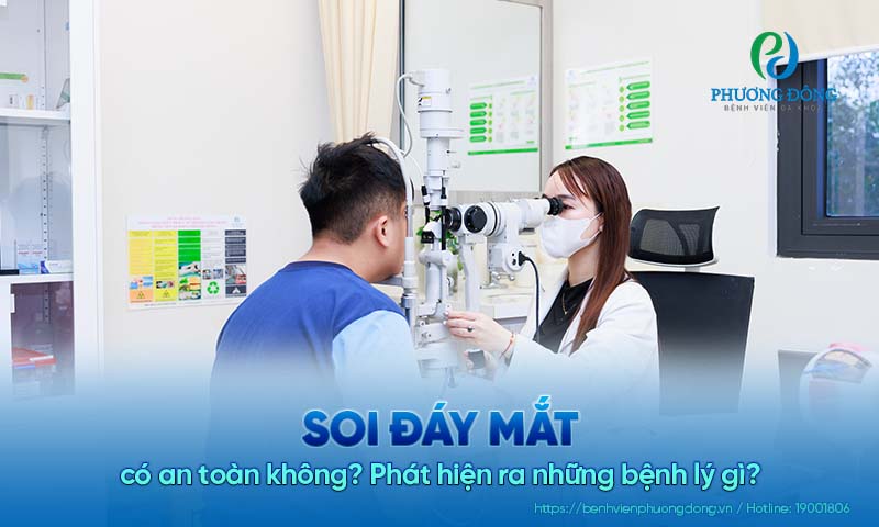 Soi đáy mắt có an toàn không? Phát hiện ra những bệnh lý gì? 
