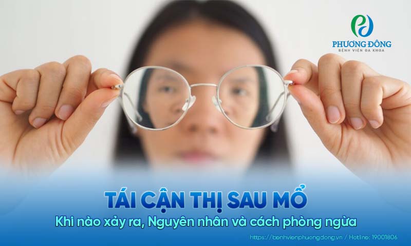 Tái cận thị sau mổ: Khi nào xảy ra, Nguyên nhân và cách phòng ngừa 