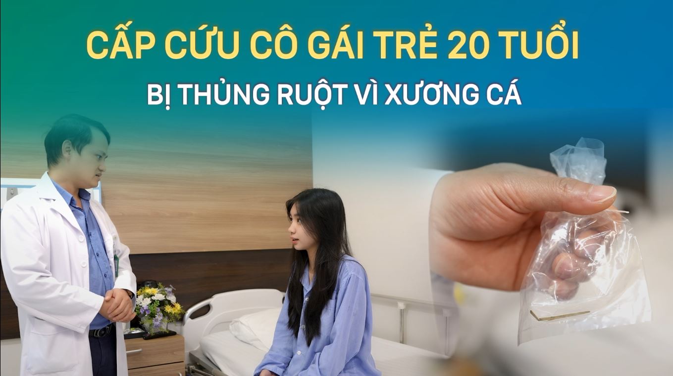 Cấp cứu cô gái trẻ 20 tuổi bị thủng ruột vì xương cá