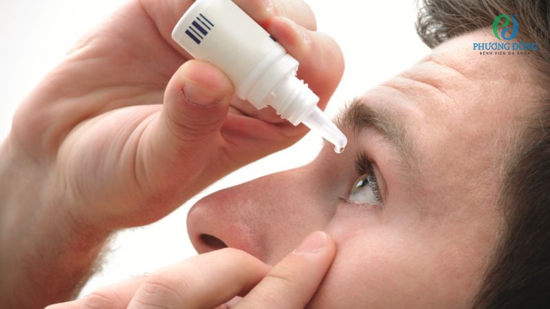 Làm tan tụ máu bằng thuốc theo đơn kê của bác sĩ Nhãn khoa