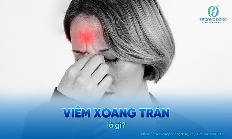 Viêm xoang trán: Nguyên nhân, triệu chứng và điều trị