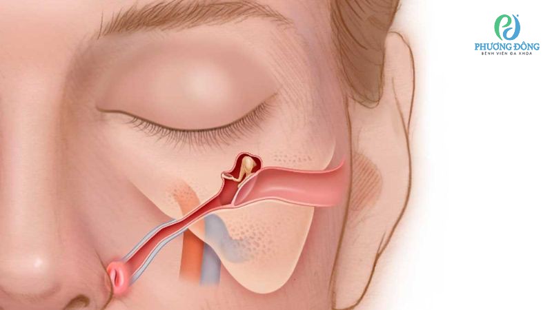 Ống Eustache đảm nhiệm chức năng cân bằng áp suất giữa môi trường trong và ngoài tai