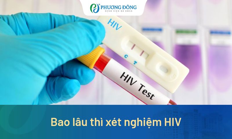 Bao lâu thì xét nghiệm HIV để có kết quả chính xác?