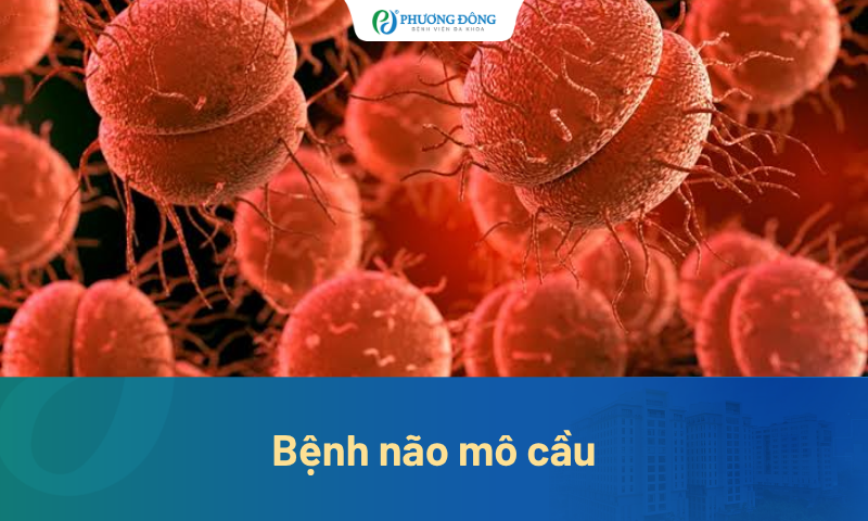 Trẻ bị sốt, đau đầu có phải mắc bệnh não mô cầu? Dấu hiệu nào cần đi viện ngay