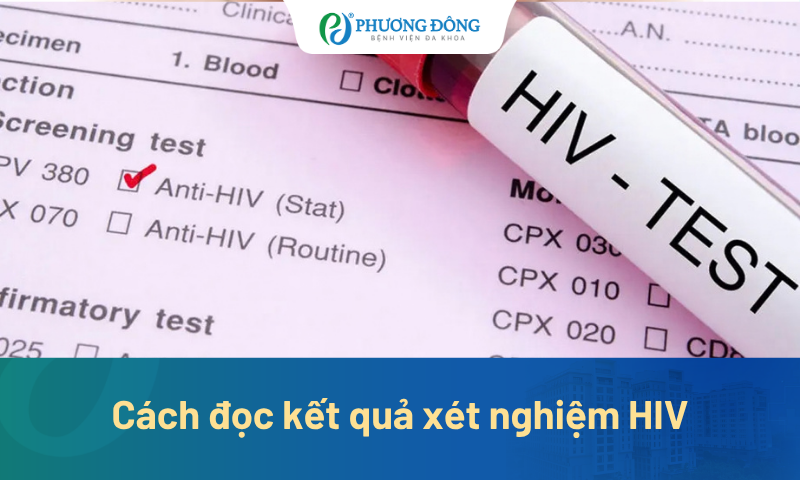 Cách đọc kết quả xét nghiệm HIV: Khi âm tính đã thực sự yên tâm chưa?