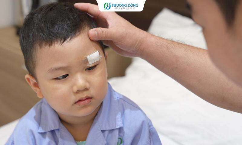 Cú ngã khiến bé 3 tuổi rách sâu cung mày, bác sĩ khâu thẩm mỹ vết thương dài 4cm