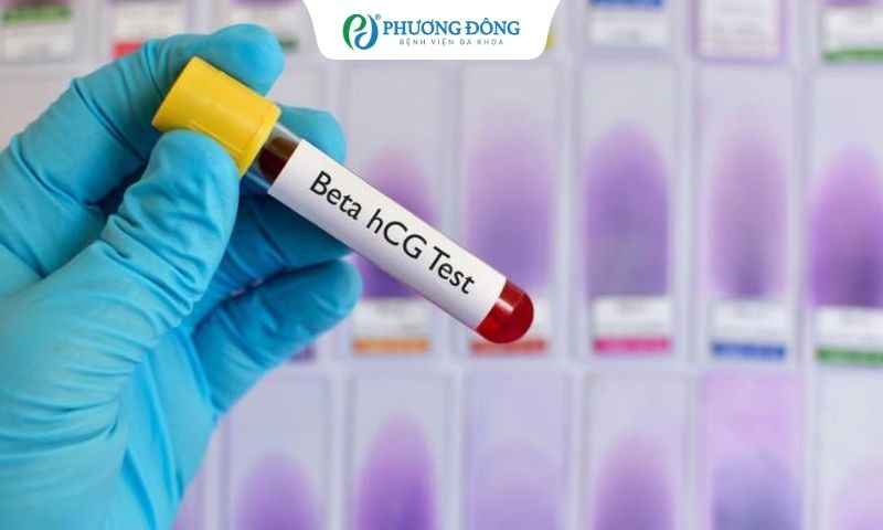 Beta ngày 8 như nào là bình thường?