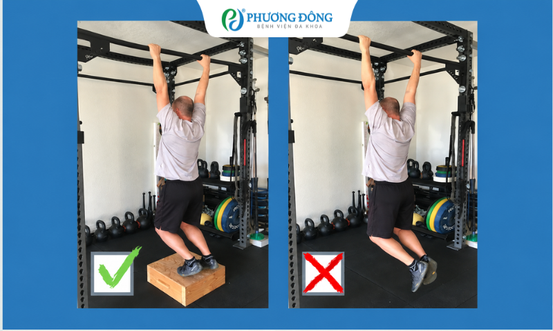 Bị thoát vị đĩa đệm cột sống thắt lưng có tập xà đơn được không?