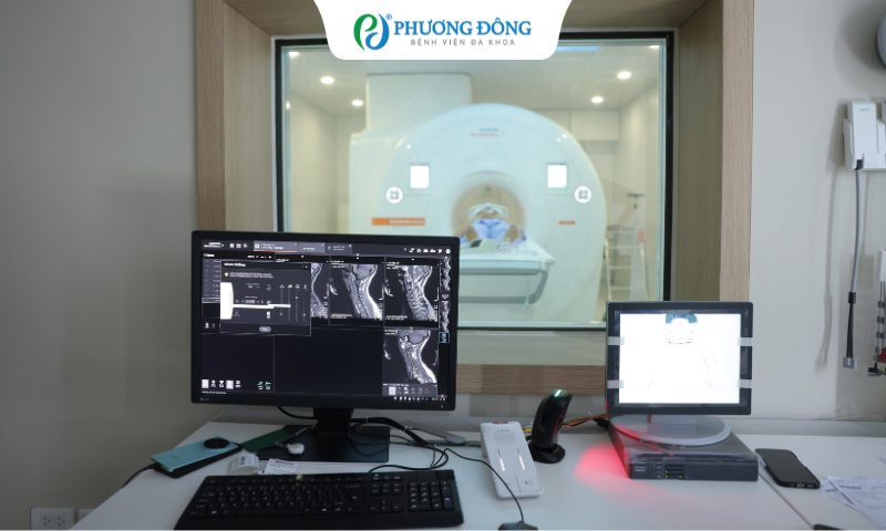 Có thể chụp MRI cột sống & sọ não cùng lúc được không?
