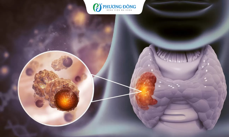 Dấu hiệu ban đầu của K giáp là gì?