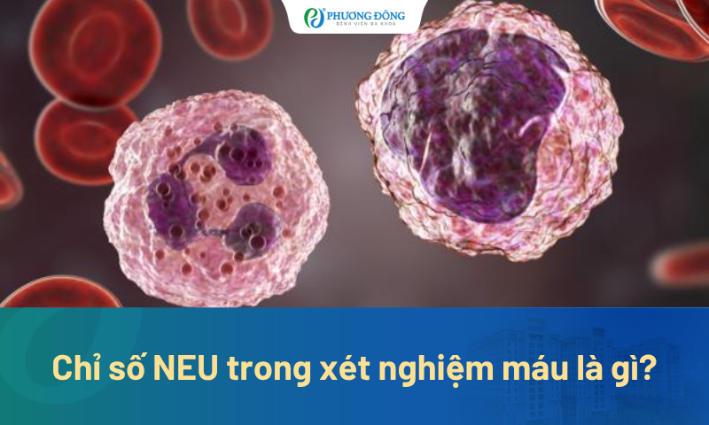Chỉ số NEU trong xét nghiệm máu là gì? Phản ánh điều gì về sức khỏe?