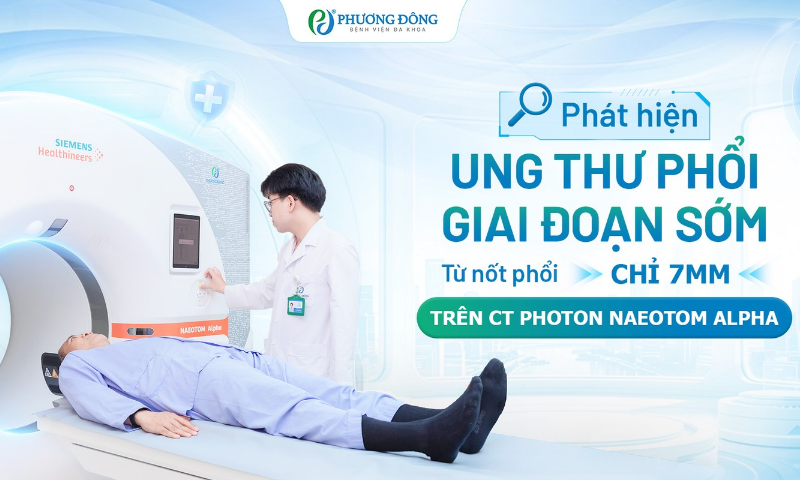Phát hiện ung thư phổi giai đoạn sớm từ nốt phổi chỉ 7mm trên CT Photon NAEOTOM Alpha