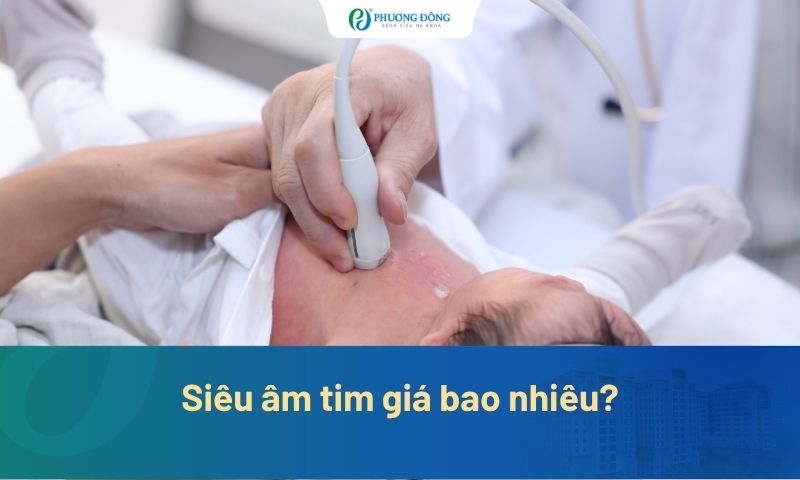 Siêu âm tim giá bao nhiêu? Chi phí theo từng chỉ định