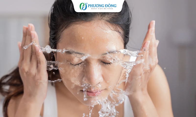 Bác sĩ khuyến cáo những người đang điều trị mụn trứng cá nên rửa mặt nhẹ nhàng 2 lần/ ngày