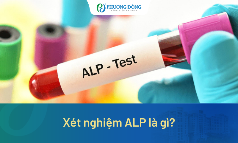 Xét nghiệm ALP là gì? Ý nghĩa chỉ số ALP trong máu