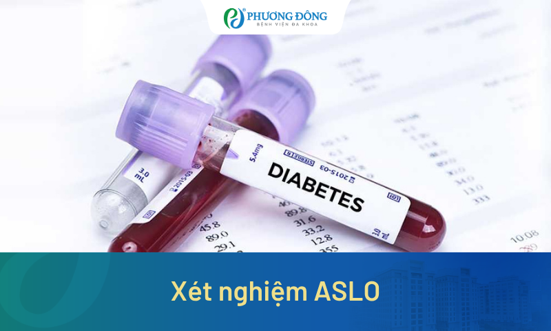 Xét nghiệm ASLO giúp phát hiện bệnh lý gì? Khi nào được chỉ định?