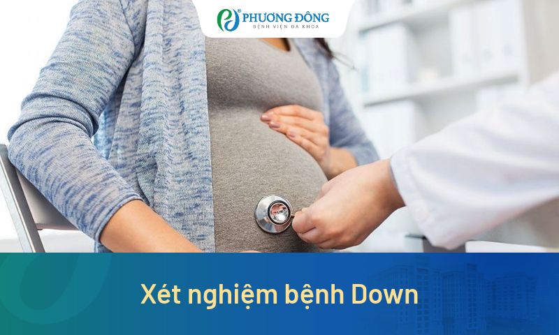 Xét nghiệm bệnh Down - Phương pháp sàng lọc và chẩn đoán bệnh