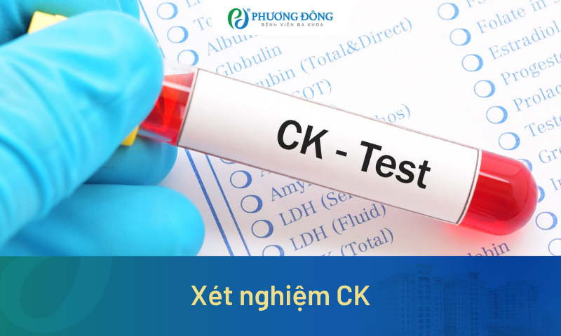 Xét nghiệm CK có ý nghĩa gì? Khi nào cần thực hiện?