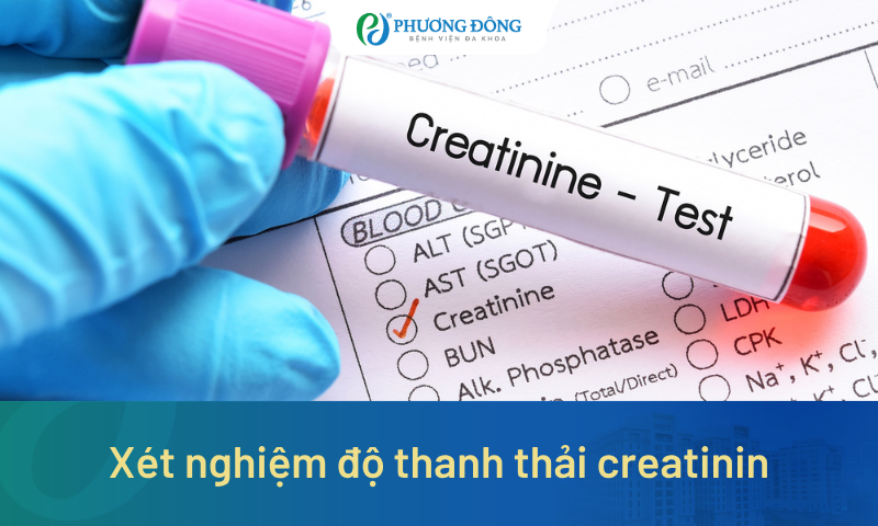 Xét nghiệm độ thanh thải creatinin phát hiện ra bệnh lý gì? Khi nào cần thực hiện