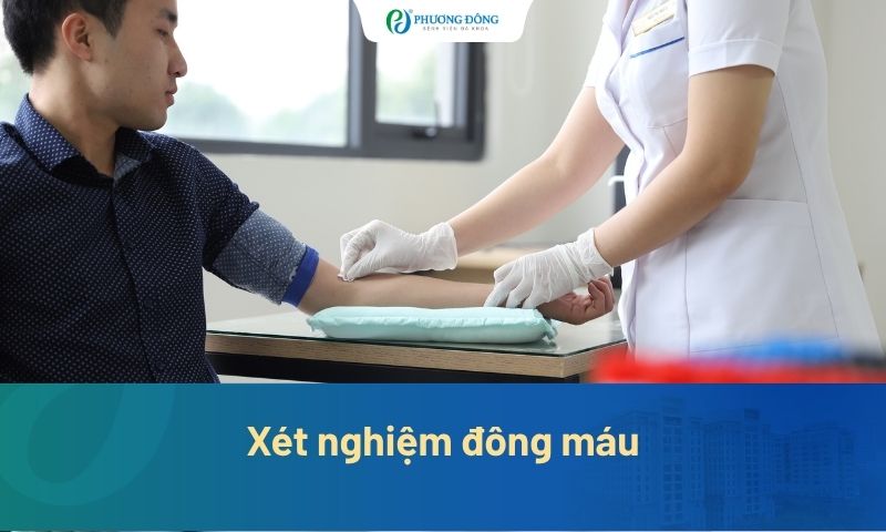 Xét nghiệm đông máu gồm những gì? Cách đọc kết quả chi tiết